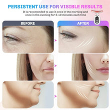 Neck & Face Wrinkle Remover