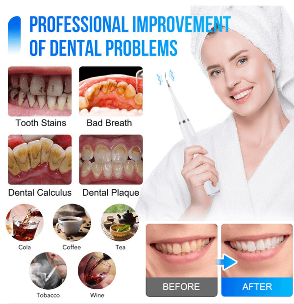 Electric Teeth Cleaner 2 in 1 Teeth cleaning tip with Toothbrush Head